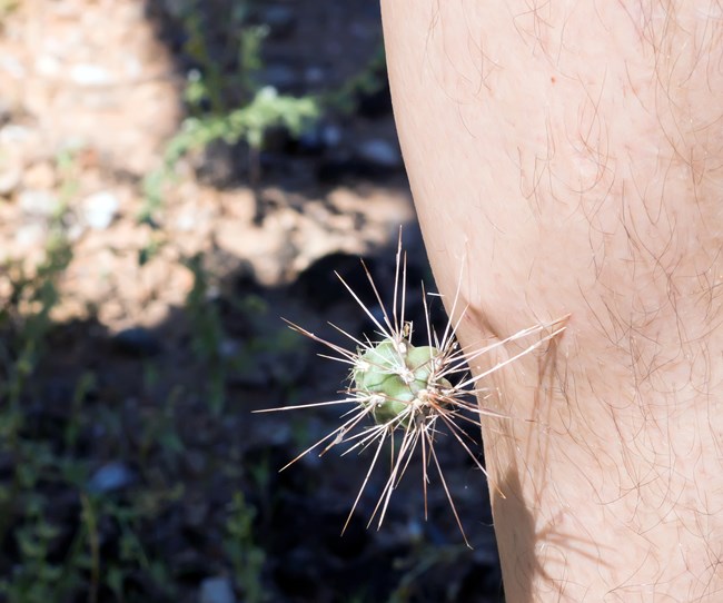 A cactus with large spines stuck in someone's arm.