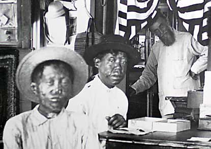 Boys with Hansen's Disease with Brother Dutton