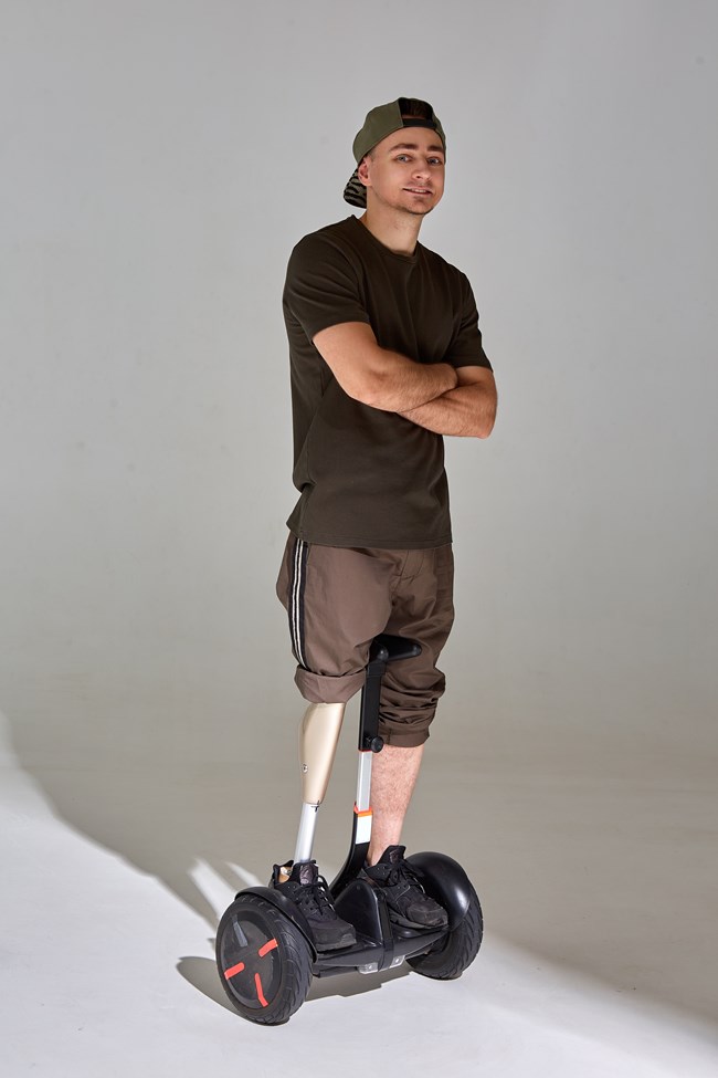 Man with an artificial leg stands on a Segway-style mobility device