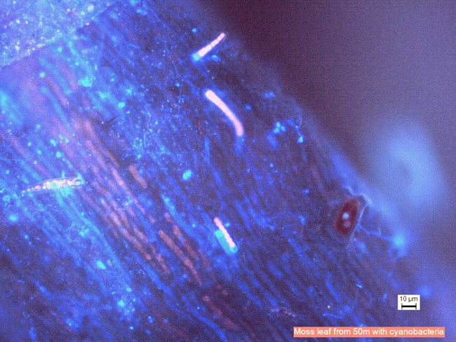 Microscopic blue moss leaf covered with pink bacteria