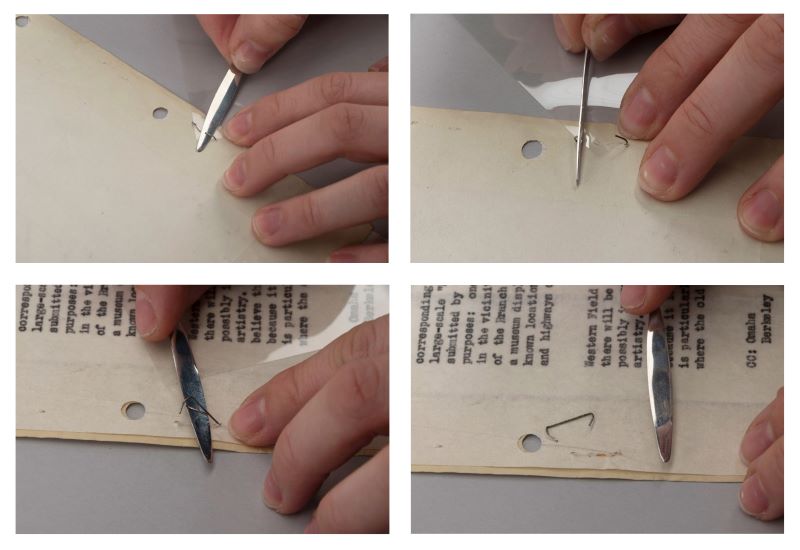 Step by step process of removing a staple.