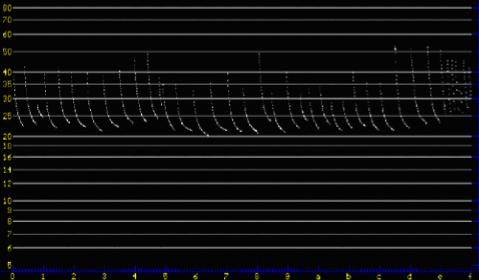 Sample vocalization of a silver-haired bat (Lasionycteris noctivagans) collected through the Anabat II Detector System.