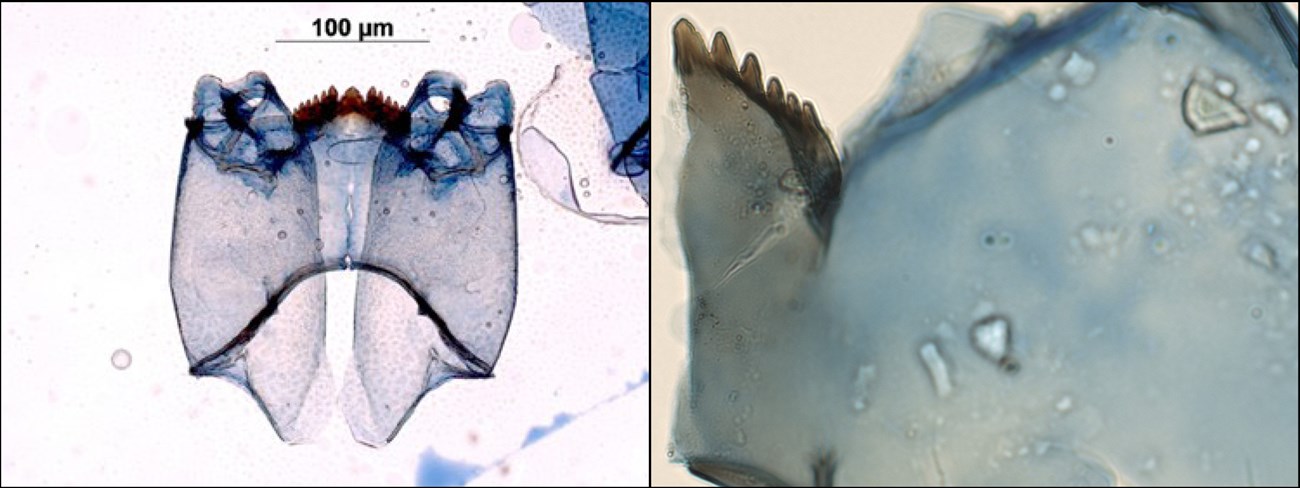 Microscopic views of a couple benthic organisms