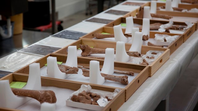 Amputated limbs from skeletal remains