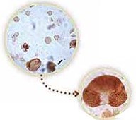 Residue of pollen, which is then stained red and mounted on a microscope slide