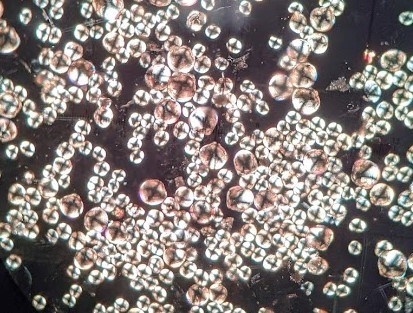 Microscopic image with many circular things stuck to each other
