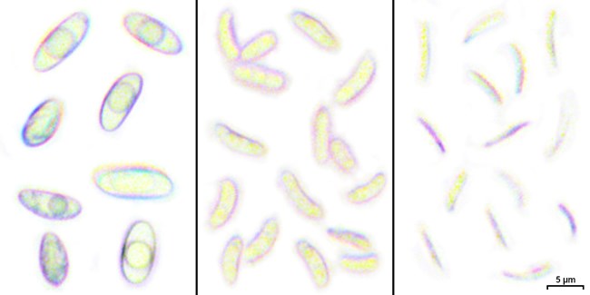 Lecanora saligna spores and conidia