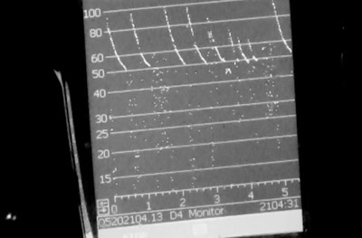 View of bat calls on echo locator device